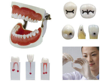歯冠修復・歯内療法