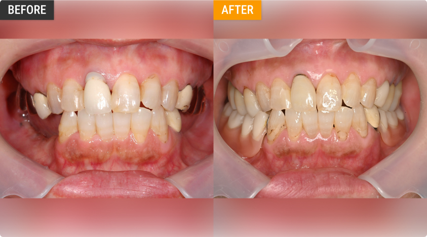 症例3-1