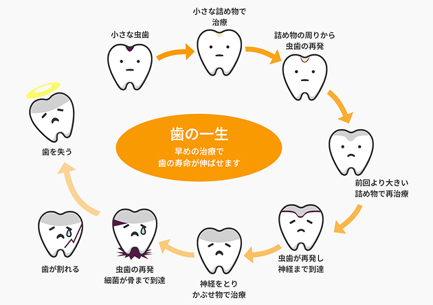 予防歯科