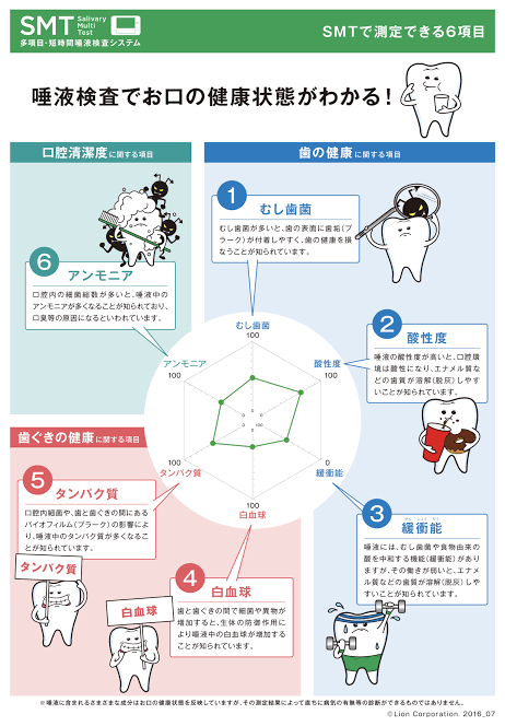 SMT検査関連イメージ 4