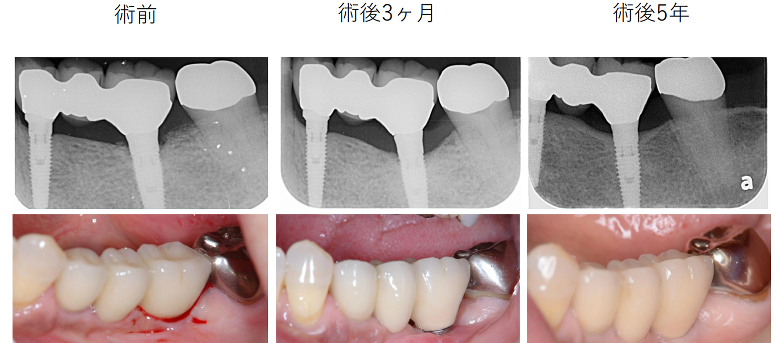 一般的な歯科医院の限界