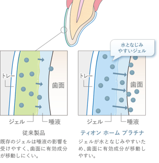 医療ホワイトニングの様子 3